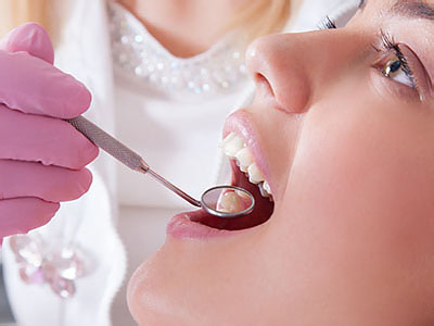 A person getting their teeth cleaned by a dental professional.